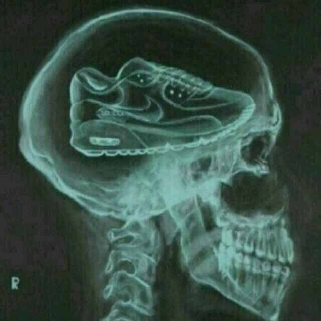 满脑鞋念