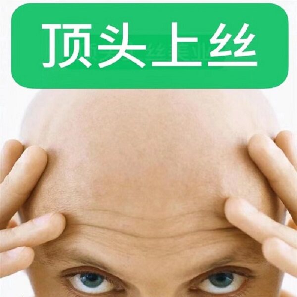 顶头上丝美业