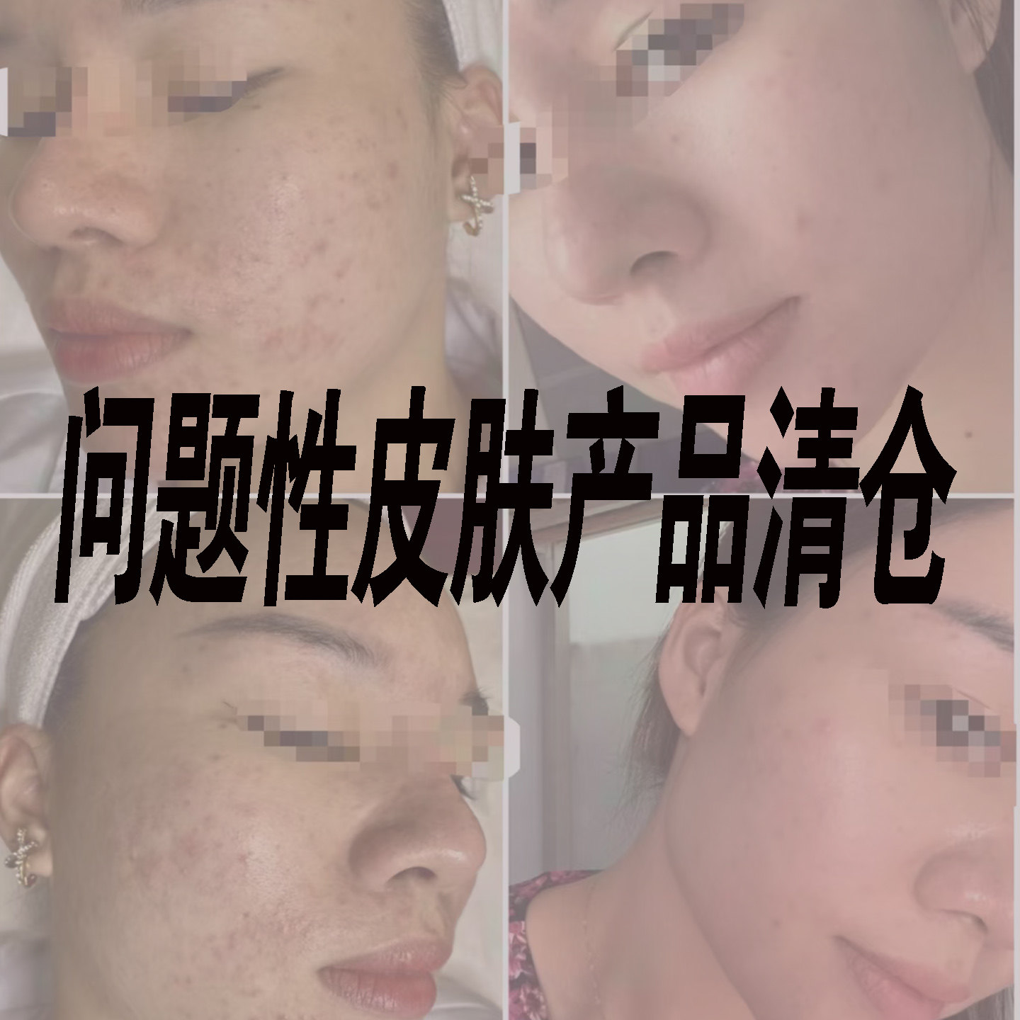 春久产品清仓问题性皮肤管理