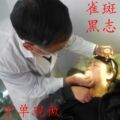 祖传点雀斑黑痣