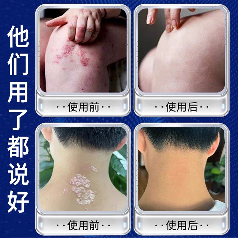 卓源医疗器械专营店