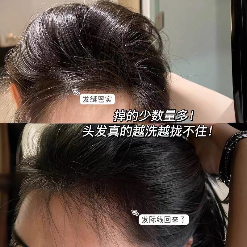 Downtown头皮护理
